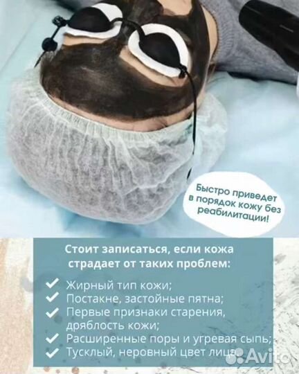Карбоновый пилинг,лазерная эпиляция
