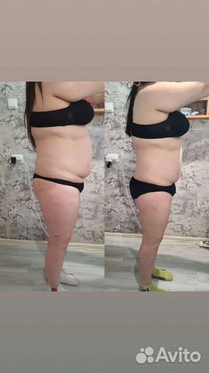 Аппаратная коррекция фигуры: вакуумный массаж