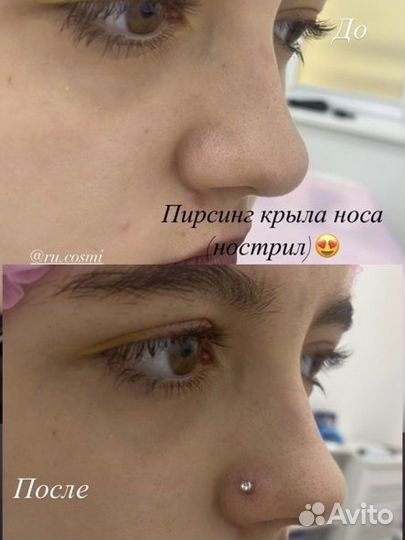Пирсинг,прокол мочек ушей