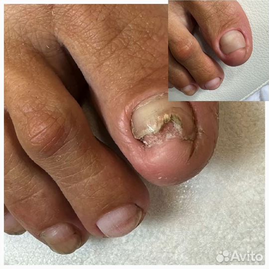 Подолог(проблемные ногти,стопы)
