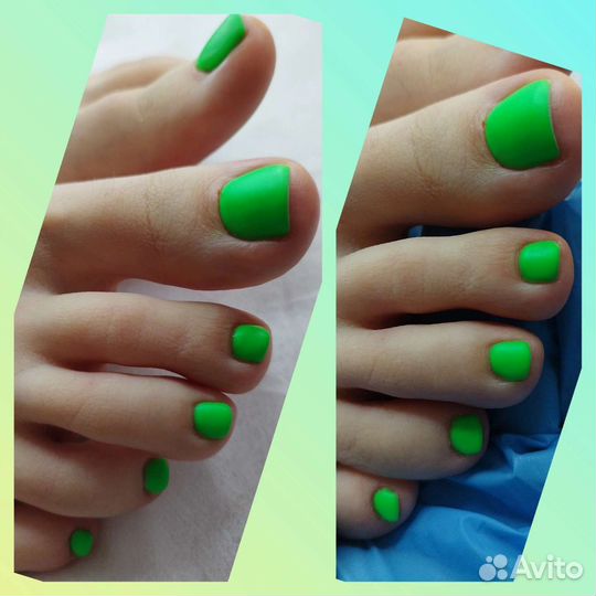 Педикюр на дому