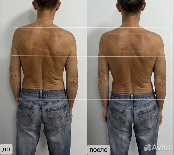 Массаж кинезиологический.Мануальный.Висцеральный