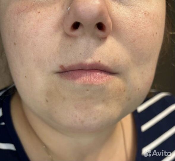 Перманент губ, ресницы, брови