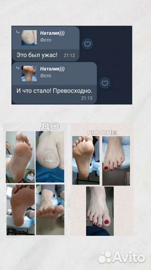 Педикюр. Smart педикюр