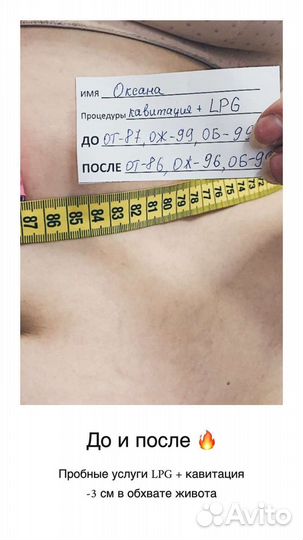 LPG массаж,кавитация,рф лифтинг, массаж лица