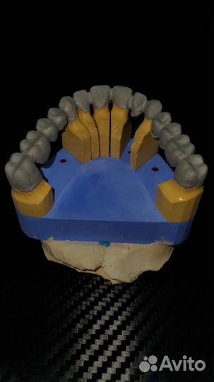 CAD/CAM. Литье. Циркон. E-max