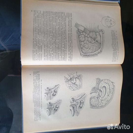 Нейрохирургия И. М. Иргер 1971 г.-книга