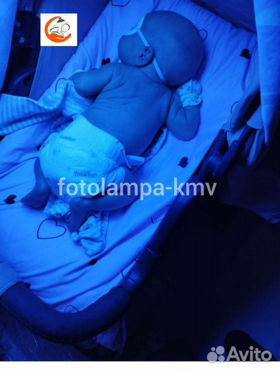 Лампа от желтушки