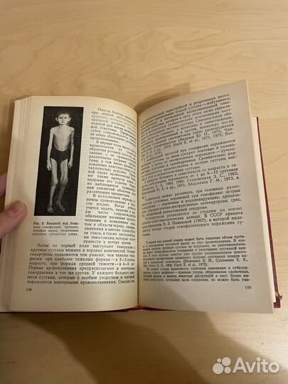 Геморрагические заболевания и синдромы: Баркаган