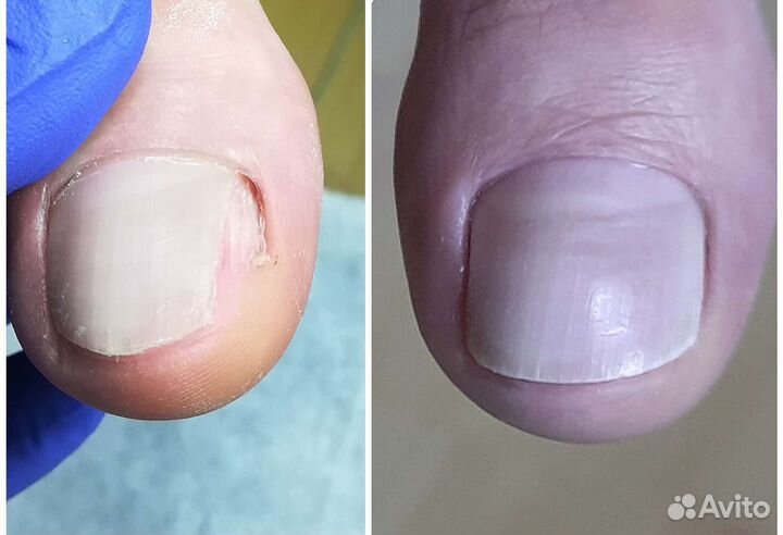 Подолог Алтуфьево Бибирево свао