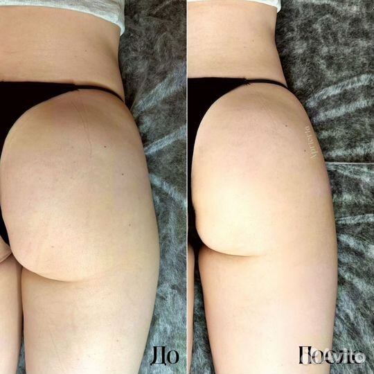 Аппаратный массаж лица и тела