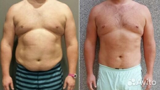 Оздоровительные процедуры,похудение,массаж