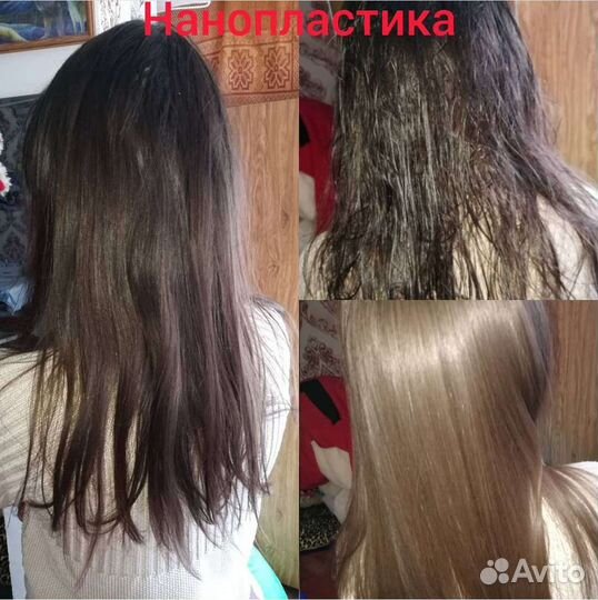 Нанопластика, ботокс, наращивание волос