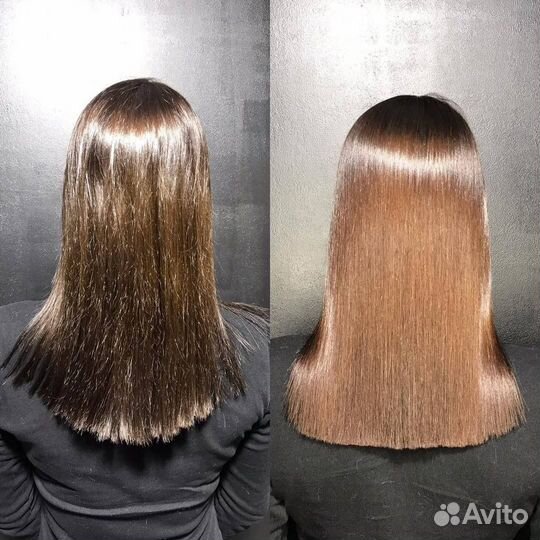 Горячий ботокс