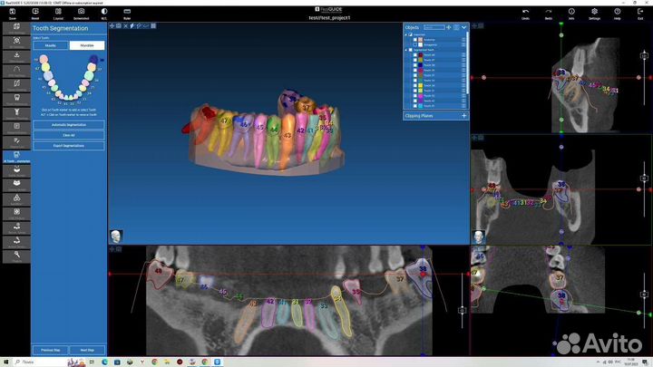 Exocad 3.1RijekaExoplan3.13Shape 2023RealGuide 5.3