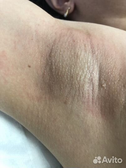 Шугаринг воск модели