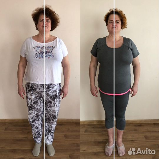 Фейспластика