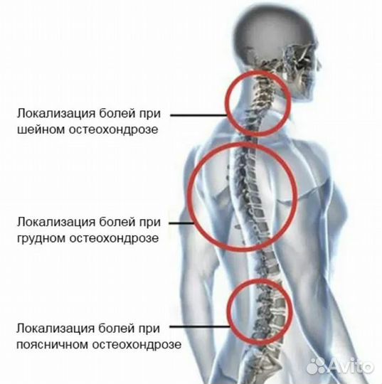 Боли от шейного остеохондроза. Боли при грудном остеохондрозе. Остеохондроз поясничного отдела симптомы. Грудной остеохондроз и сердце. Стмтомы грудного остео.