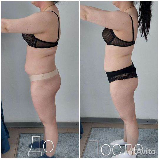 Мастер LPG массажа