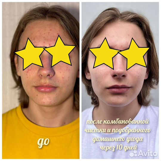 Услуги косметолога