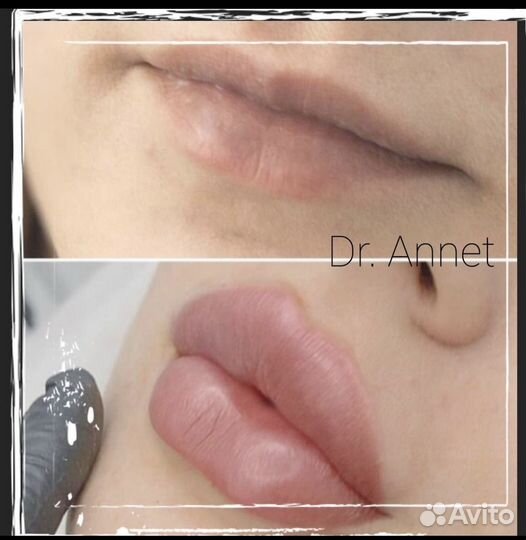 Врач косметолог