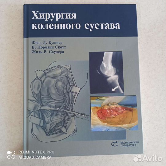 Хирургия коленного сустава Ф. Кушнера