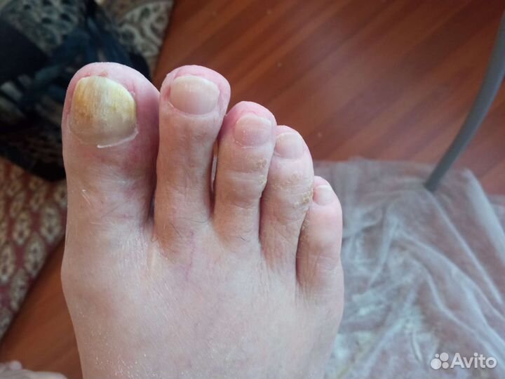 Педикюр.Выезд на дом к пожилым людям