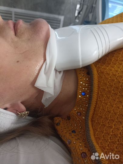 Криолиполиз