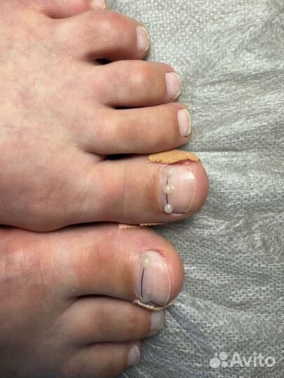 Курсы по подологии для начинающих