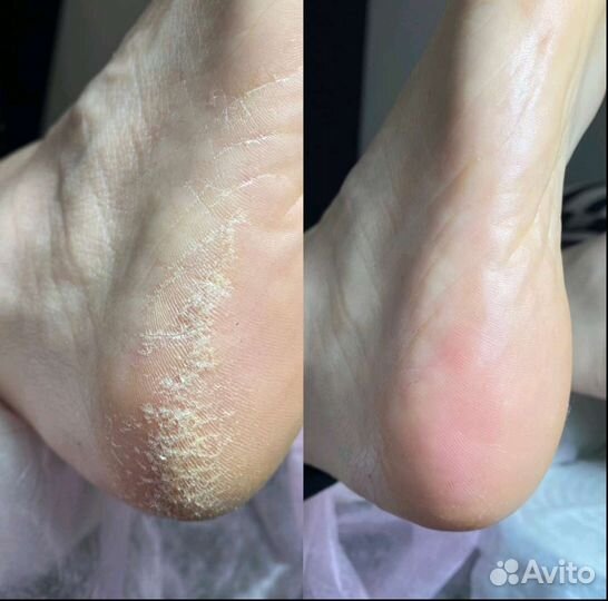 Педикюр дисками