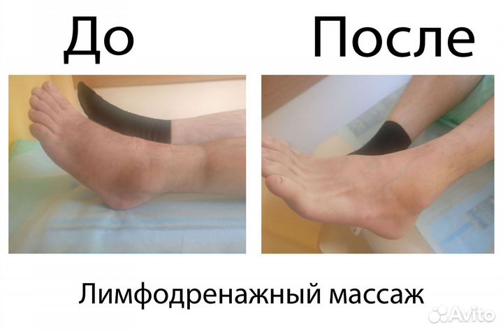 Детский Массаж лфк с Выездом на Дом