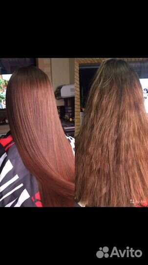 Ботокс,Нанопластика