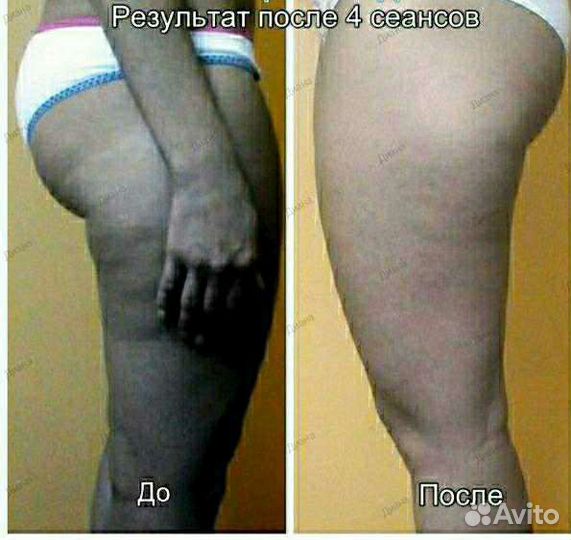 Массаж для похудения