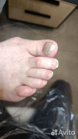 Медицинский педикюр. Подолог для мужчин и женщин