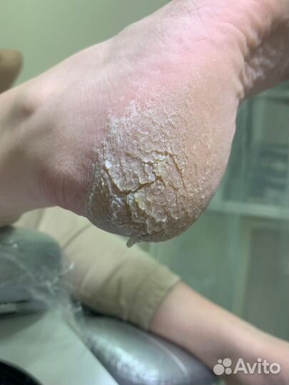 Маникюр и SMART педикюр