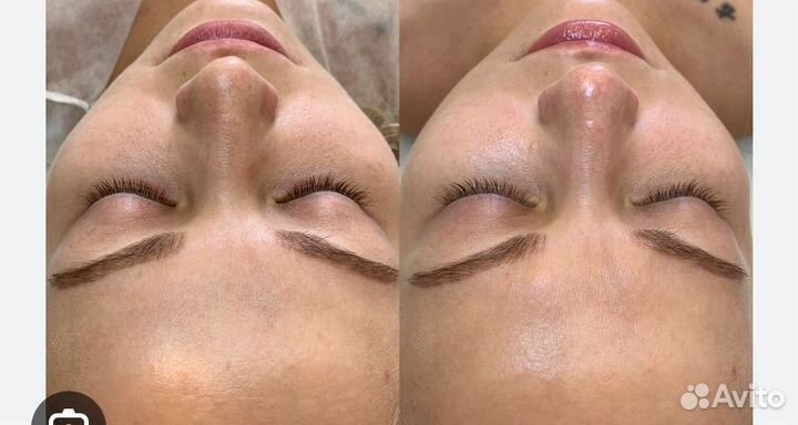 Массаж лица