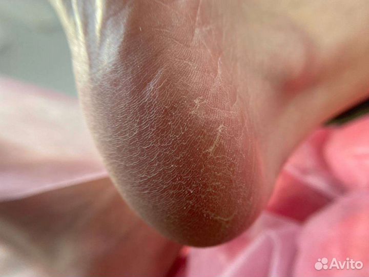 Смарт педикюр