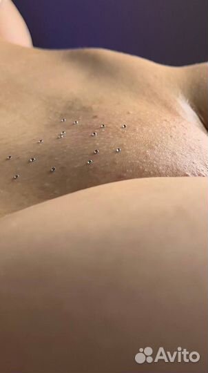 Депиляция