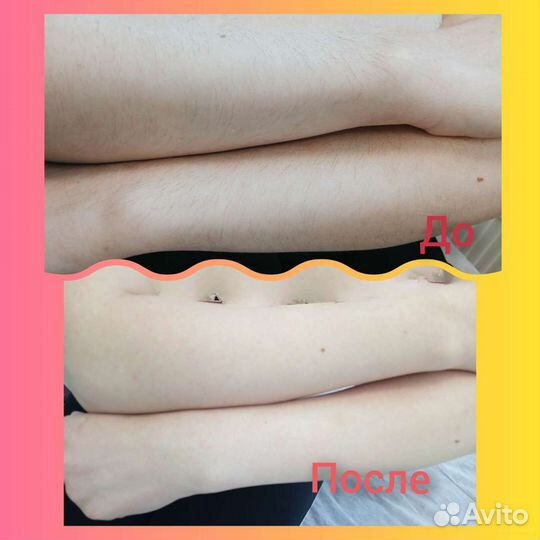 Шугаринг,обучение, массаж