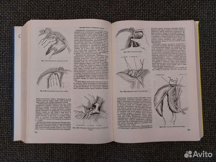 Оперативная Хирургия. Имре Литтманн