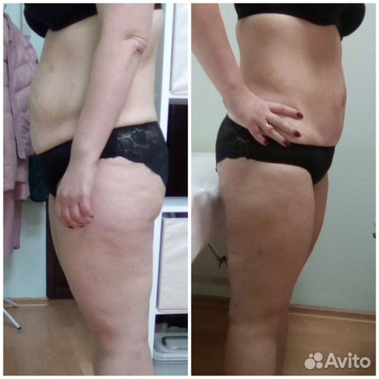 LPG массаж, 3Д моделирование и др