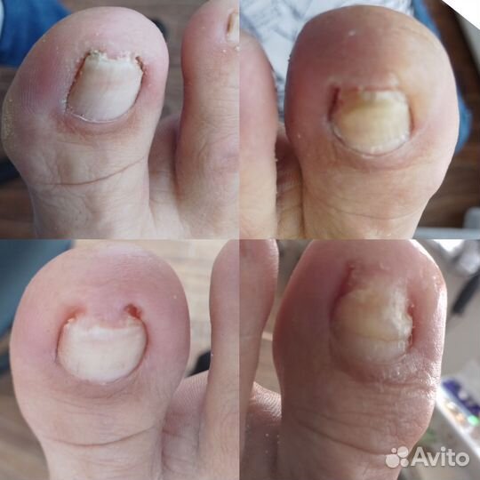 Услуги подолога