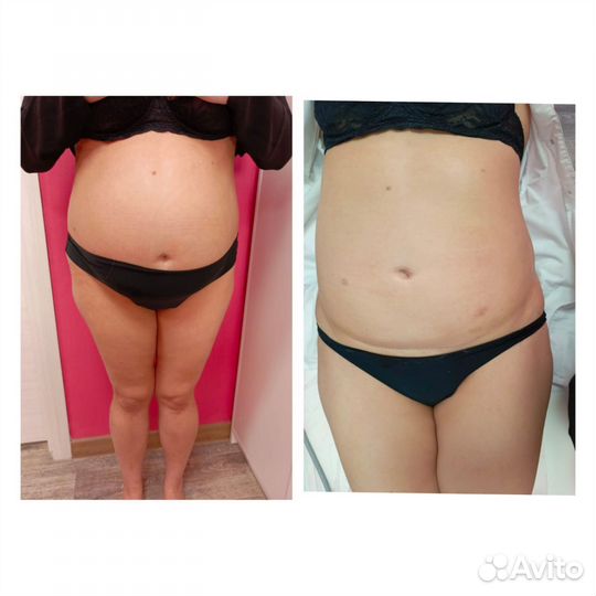 Худой живот