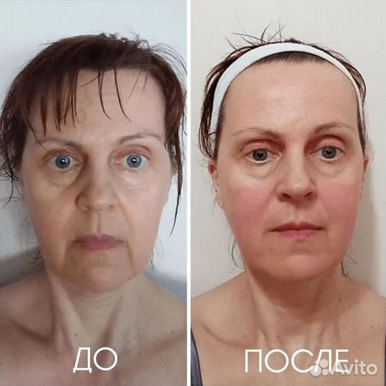 Массаж,корекция фигуры