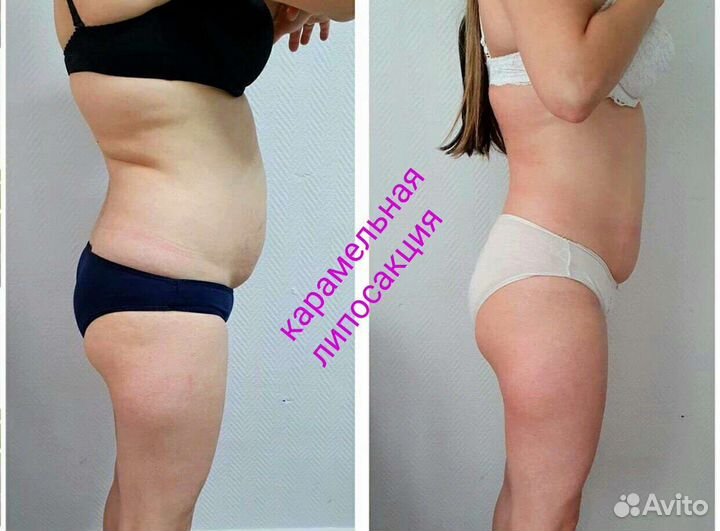 Массаж лица и тела. Коррекция фигуры