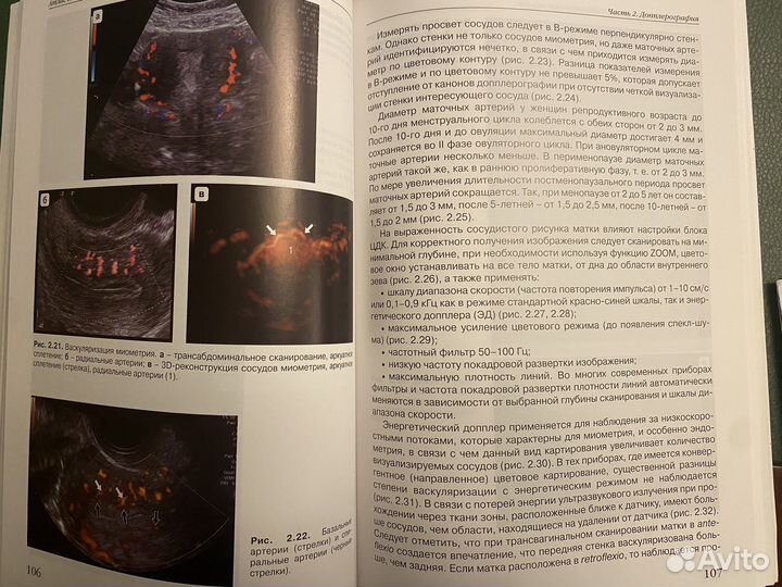 Атлас гинекологич ультразв нормы.Озерская И.А