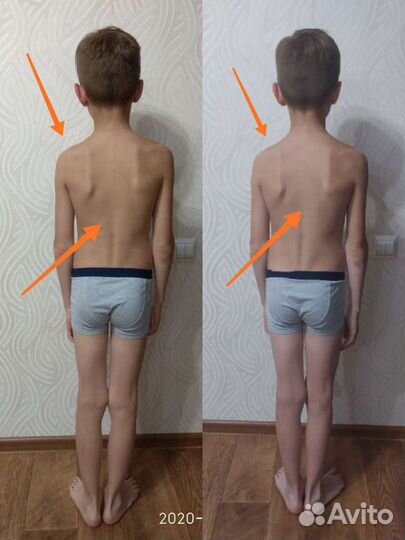 Оздоровление организма (коррекция осанки, работа с