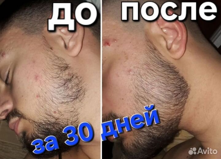 Лосьон для роста волос