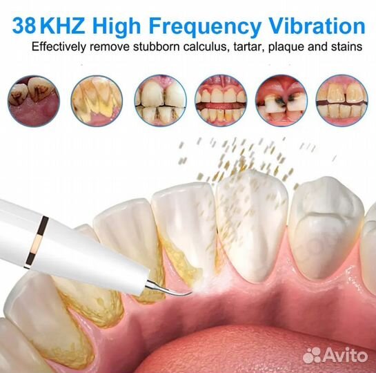 Ультразвуковой скалер