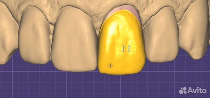 Курс по ExoCad, программа в подарок